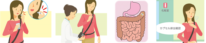 カプセル内視鏡